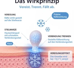 Acetocaustin Stielwarzen Entferner 50 ml Stift