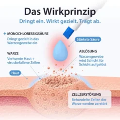 Acetocaustin Stift gegen Warzen 3 ml