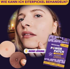 Benzacare Power Patch Skin Repair 23 Pflaster