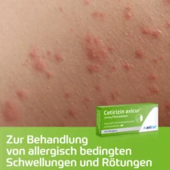 Cetirizin Axicur 10 mg 50 Filmtabletten