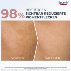 Eucerin Anti-Pigment Dual Serum 30 ml
