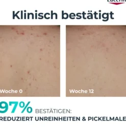 Eucerin DermoPure Clinical erneuernde Körperpflege 200 ml