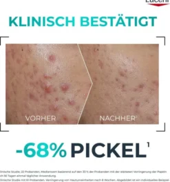 Eucerin DermoPure Clinical Probiom 8 Routine-Set 1 Stück + gratis Eucerin Sun Gel - Creme Oil Control 20 ml