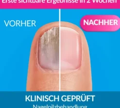 Excilor 3,3 ml Lösung Gegen Nagelpilz