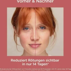 Isdin Fotoultra Redness Creme Lsf 50 50 ml