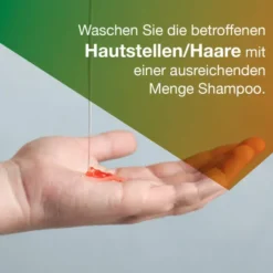 Ketozolin 2 % Shampoo 120 ml