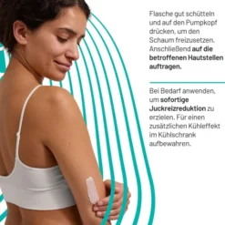 Locobase Anti-Juckreiz Schaum 100 ml