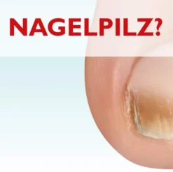 Miclast 80 mg pro g wirkstoffhaltiger Nagellack 3 ml