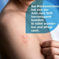 Soventol Anti - Juck Stift 4 ml Gel