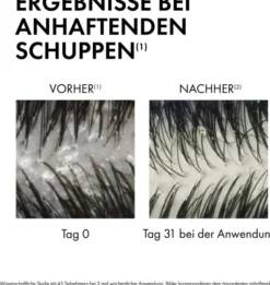 Vichy Dercos Anti-Schuppen Shampoo für fettige Kopfhaut 390 ml