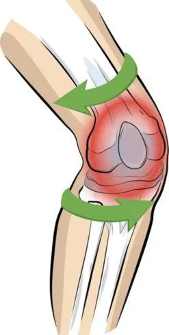 Vital Komfort Kniebandage PatellaTec Gr. L