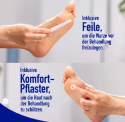 Wartner Fußwarzen 50 ml Spray